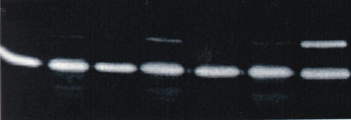 Gelatin zymogram showing MMP-2 and MMP-9 activity in vascular smooth muscle cells treated with cytokines and growth factors