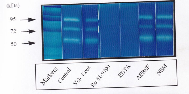 Casein zymogram with antibody immunoprecipitation lanes confirming MMP-9 and MMP-3 band identity