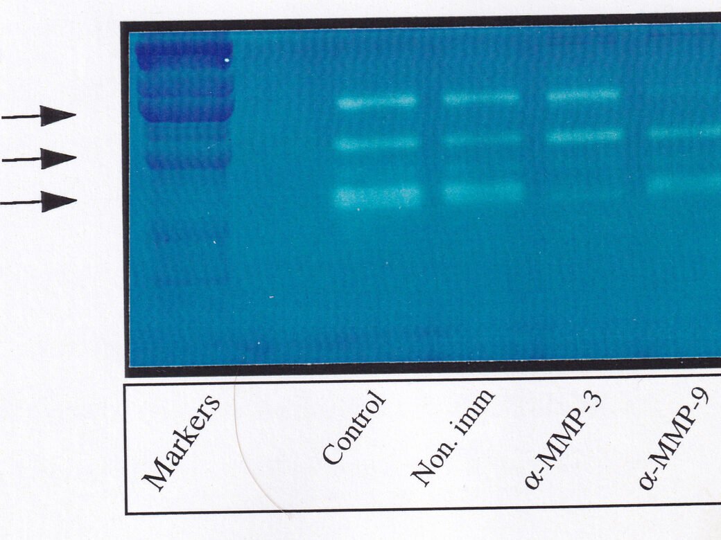 Casein zymogram with molecular weight markers and lanes treated with protease inhibitors including EDTA and Ro-31-9790