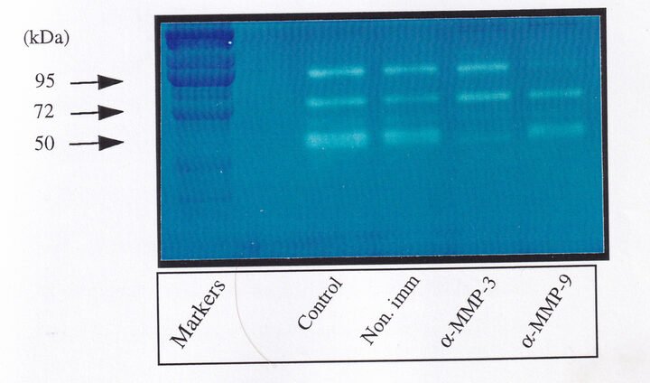 Casein zymogram gel strips treated with protease inhibitors AEBSF, NEM, Ro-31-9790, and EDTA