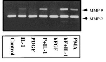 Gelatin zymogram showing MMP-2 and MMP-9 activity in vascular smooth muscle cells treated with cytokines and growth factors